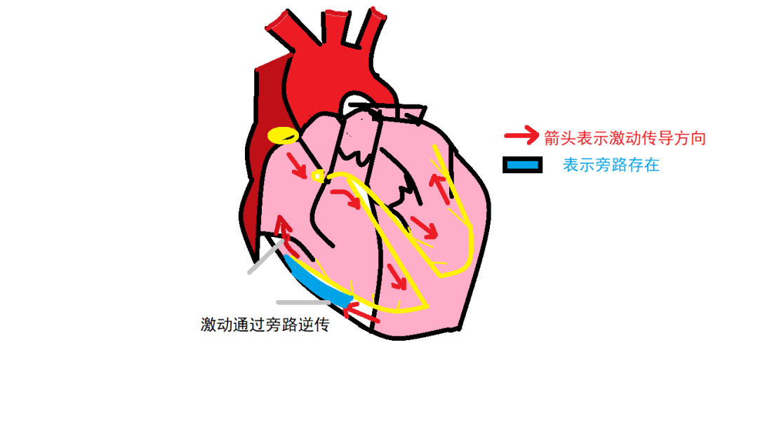 【科普】引起心跳突然加快的是“它”