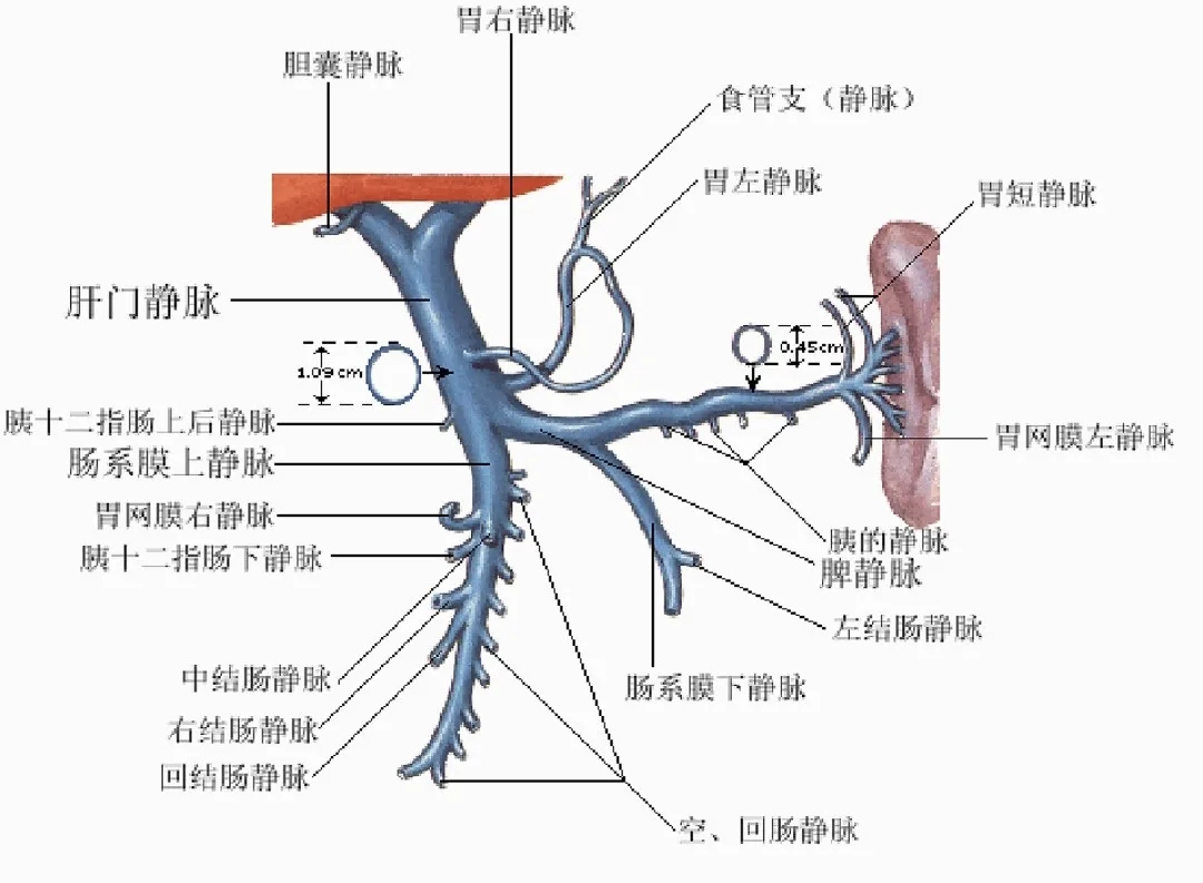 反復(fù)嘔血、黑便怎么辦？TIPS手術(shù)能解決